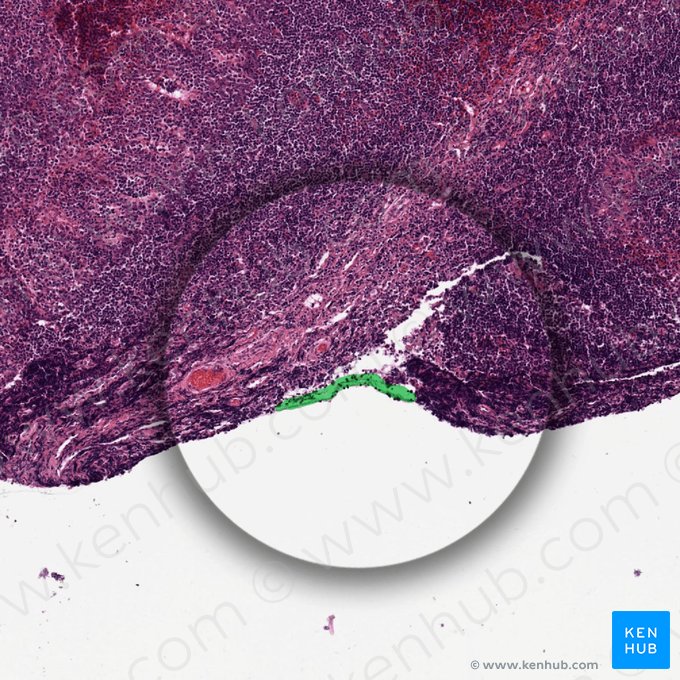 Cápsula (Capsula); Imagen: 