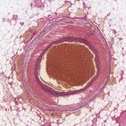 Arteries and veins histology