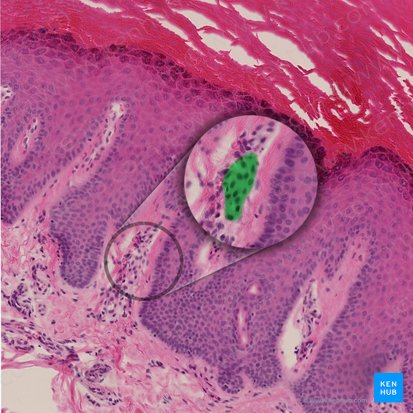 Corpúsculo de Meissner (Corpusculum tactile); Imagen: 