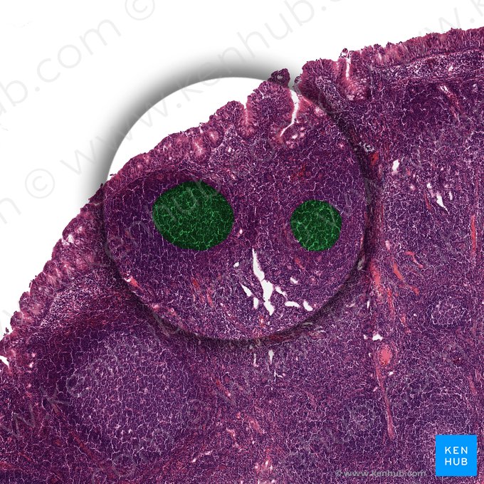 Centro marginal del ganglio linfático esplénico (Centrum germinalis); Imagen: 