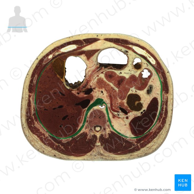 Diaphragma (Zwerchfell); Bild: National Library of Medicine