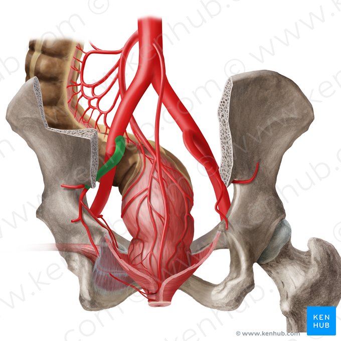 Arteria ilíaca interna (Arteria iliaca interna); Imagen: Irina Münstermann