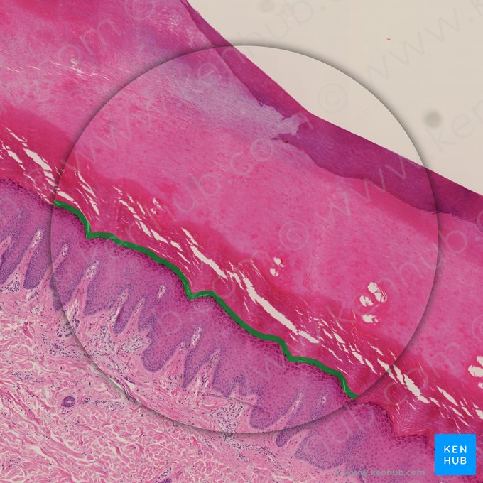 Stratum lucidum of epidermis (Stratum lucidum epidermis); Image: 