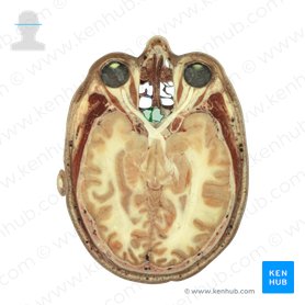 Sinus sphenoidalis (Keilbeinhöhle); Bild: National Library of Medicine