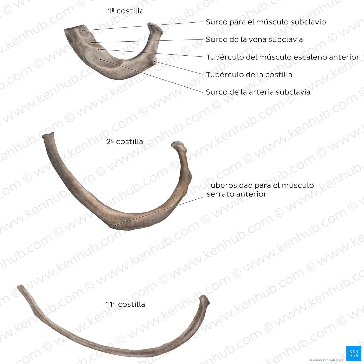 Costillas atípicas