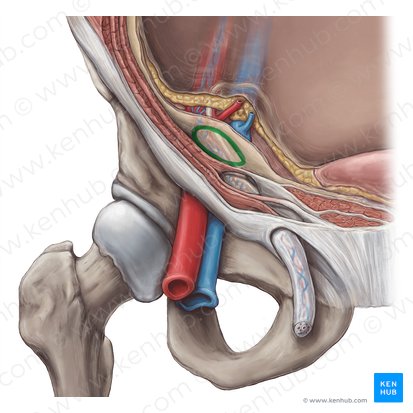 Anel inguinal profundo (Anulus inguinalis profundus); Imagem: Hannah Ely