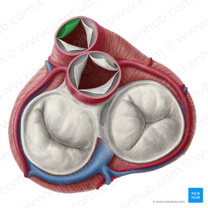 Anterior semilunar leaflet of pulmonary valve (Valvula semilunaris anterior valvae trunci pulmonalis); Image: Yousun Koh