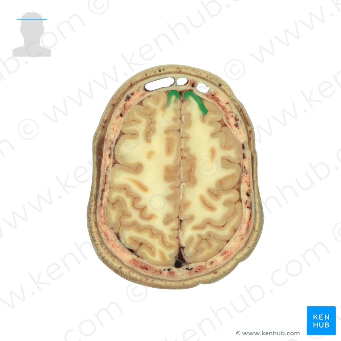 Giro frontal superior (Gyrus frontalis superior); Imagem: National Library of Medicine