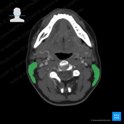 Músculo esternocleidomastóideo (Musculus sternocleidomastoideus); Imagem: 