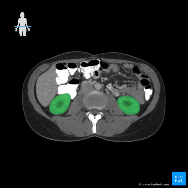 Niere - axial (CT-Schnittbild)