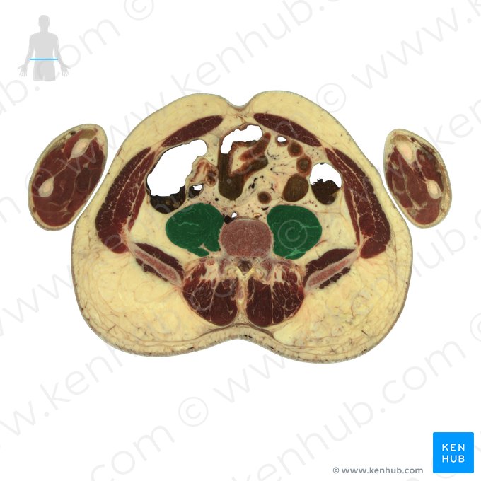 Musculus psoas major (Großer Lendenmuskel); Bild: National Library of Medicine