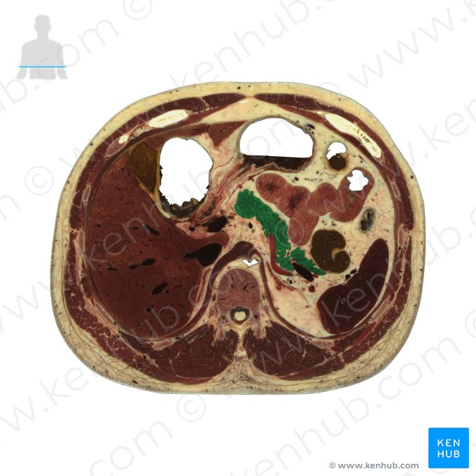 Pancreas; Image: National Library of Medicine