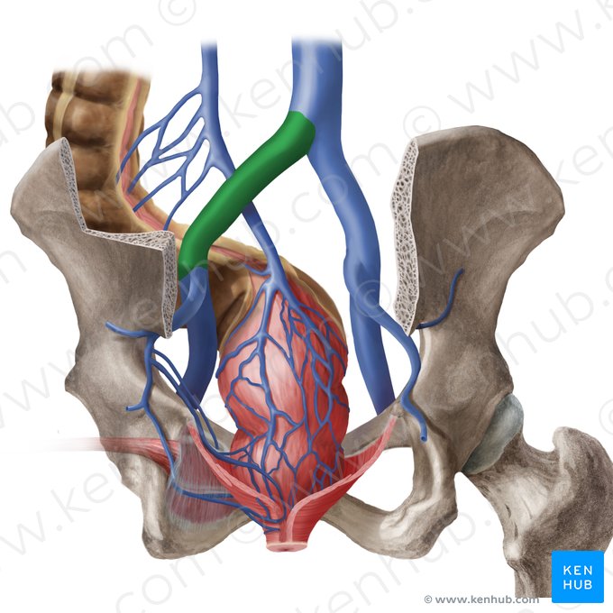 Left common iliac vein (Vena iliaca communis sinistra); Image: Begoña Rodriguez