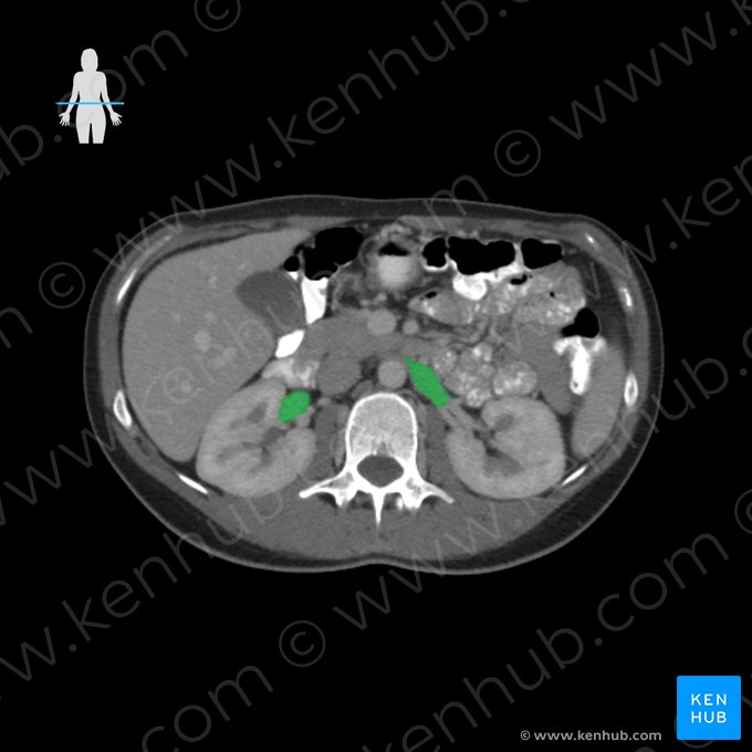 Vena renal (Vena renalis); Imagen: 