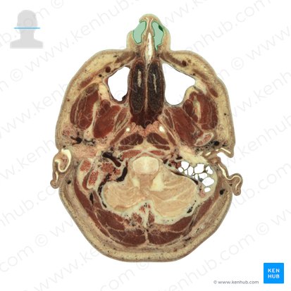 Nasal vestibule (Vestibulum nasi); Image: National Library of Medicine