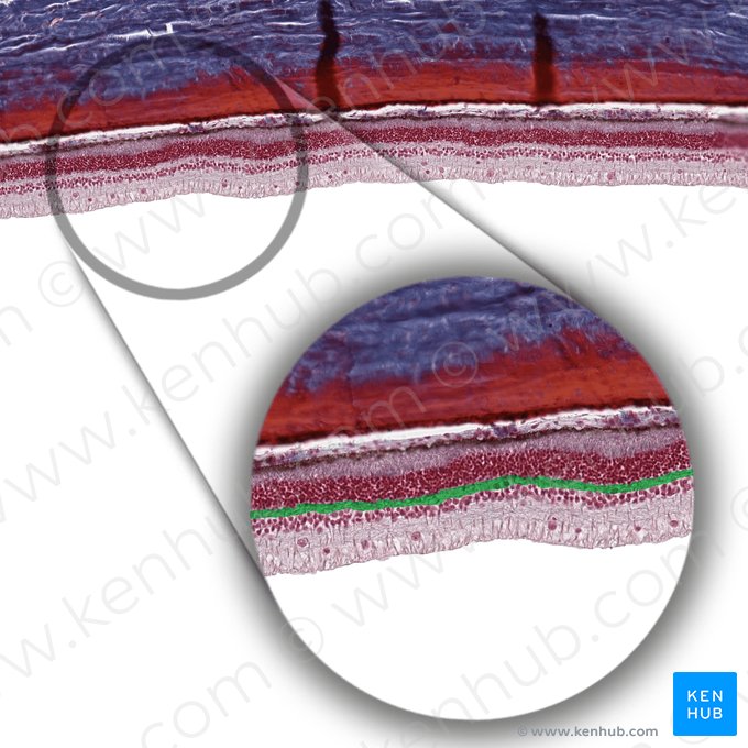 Capa plexiforme externa (Stratum plexiforme externum); Imagen: 