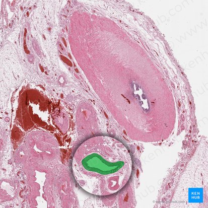 Arteria testicular (Arteria testicularis); Imagen: 