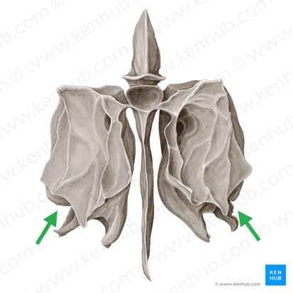 Infundíbulo etmoidal (Infundibulum ethmoidale); Imagem: Samantha Zimmerman