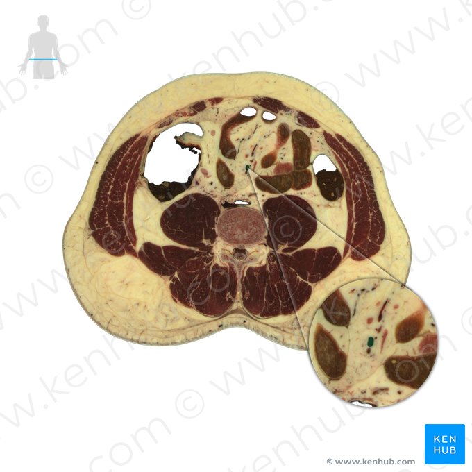 Arteria mesenterica superior (Obere Eingeweidearterie); Bild: National Library of Medicine