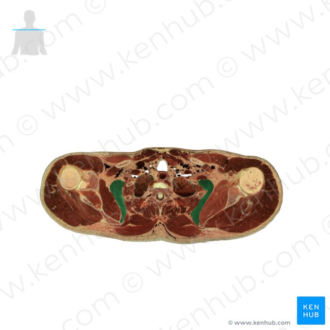 Músculo serrátil anterior (Musculus serratus anterior); Imagem: National Library of Medicine