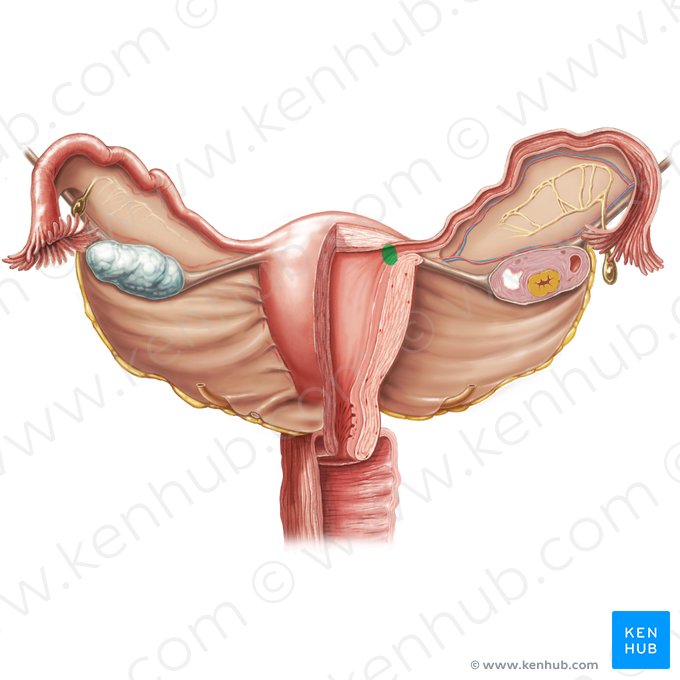 Orificio uterino de la tuba uterina (Ostium uterinum tubae uterinae); Imagen: Samantha Zimmerman
