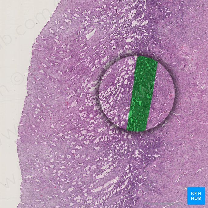 Capa basal del endometrio; Imagen: 