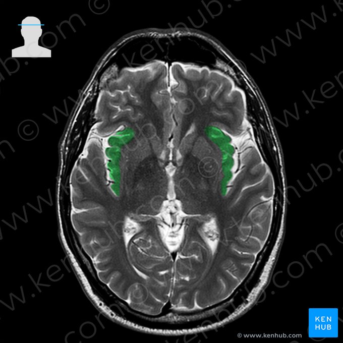 Insular lobe (Insula); Image: 