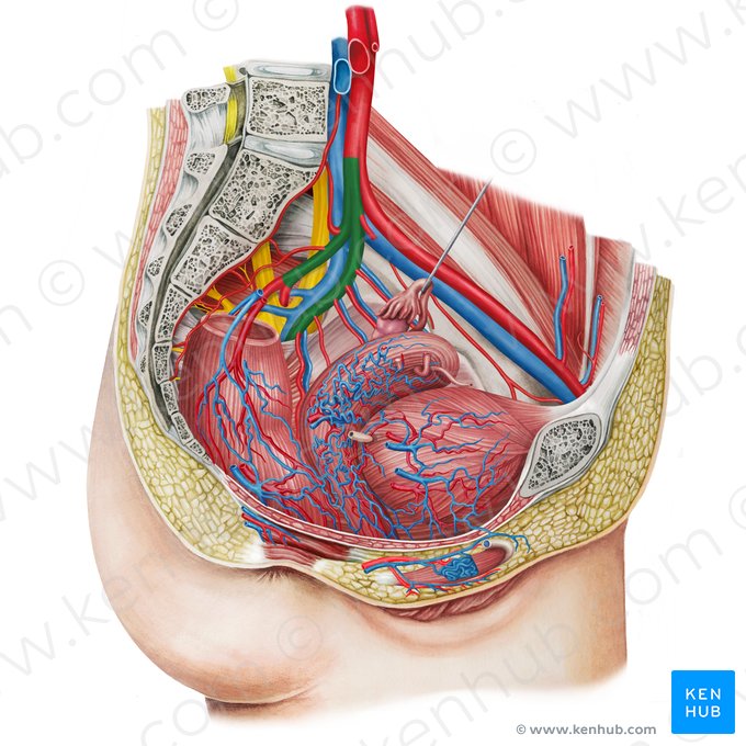 Arteria ilíaca interna izquierda (Arteria iliaca interna sinistra); Imagen: Irina Münstermann