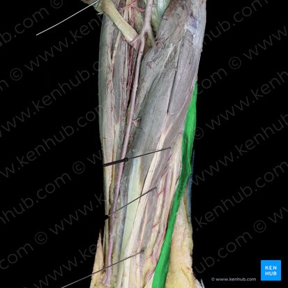 Musculus flexor carpi ulnaris (Ellenseitiger Handbeuger); Bild: 