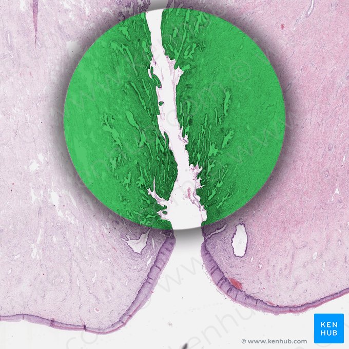 Endocervix; Image: 