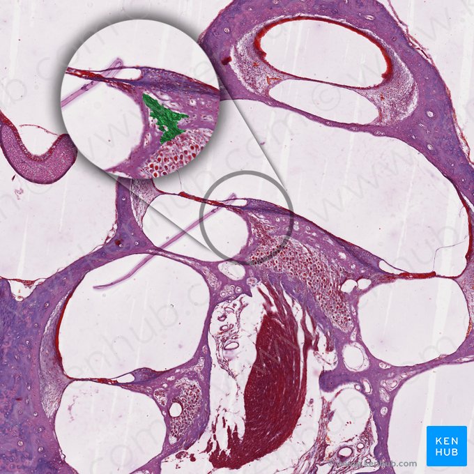 Neurofibrae periphericae nervi cochlearis (Nervenfasern des Hörnervs); Bild: 
