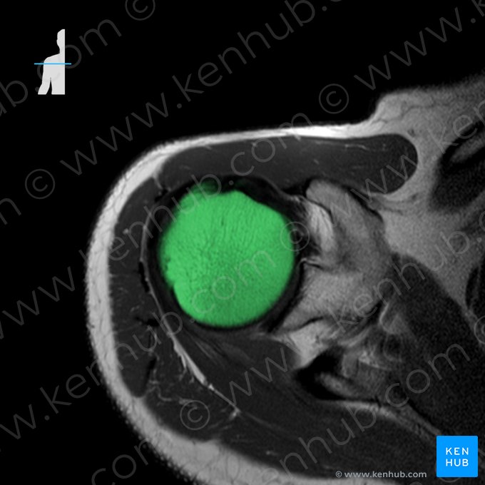 Head of humerus (Caput humeri); Image: 