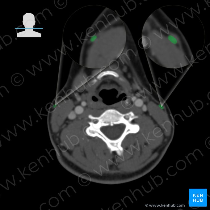 Vena yugular externa (Vena jugularis externa); Imagen: 