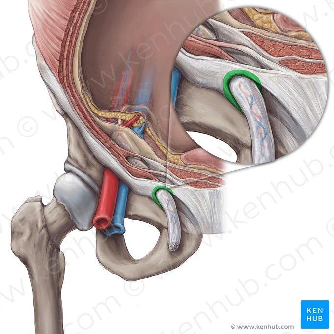 Superficial inguinal ring (Anulus inguinalis superficialis); Image: Hannah Ely