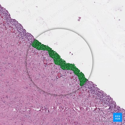 Urotélio (Urothelium); Imagen: 