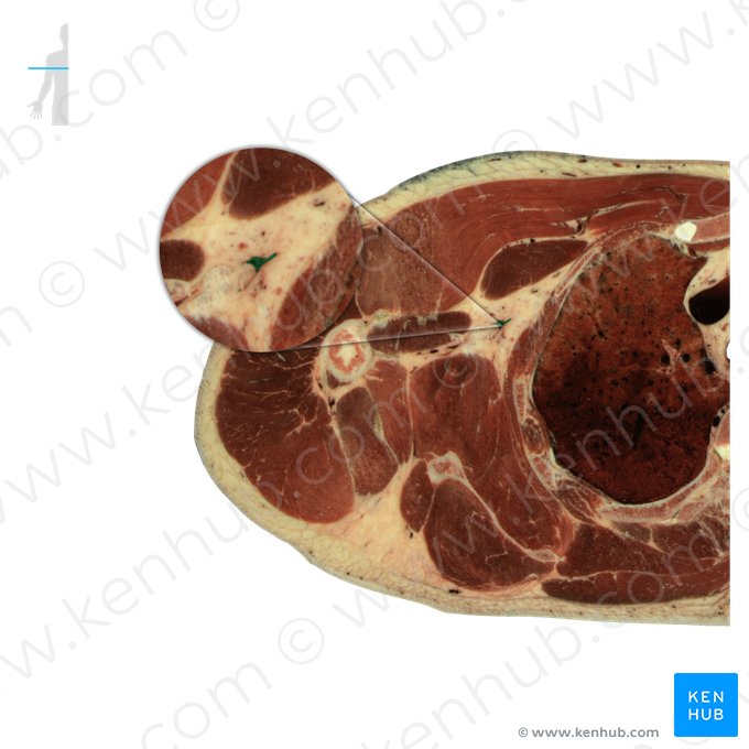 Veia axilar (Vena axillaris); Imagem: National Library of Medicine
