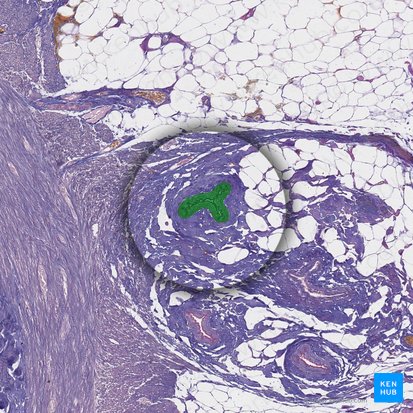 Branch of appendicular artery (Ramus arteriae appendicularis); Image: 