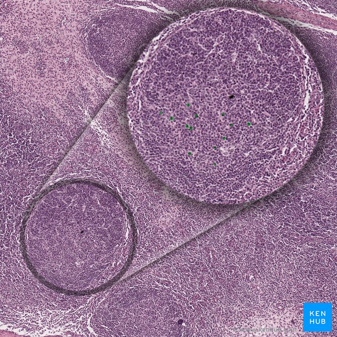 Centrocytes (Centrocytus); Image: 