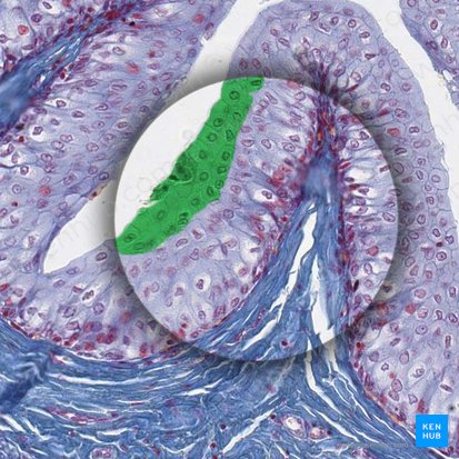 Stratum superficiale urothelii (Deckzellen des Urothels); Bild: 