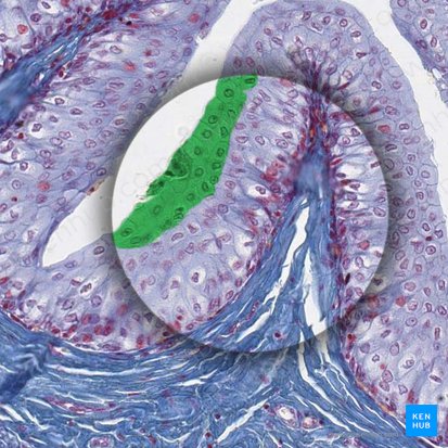 Superficial layer of transitional epithelium; Image: 