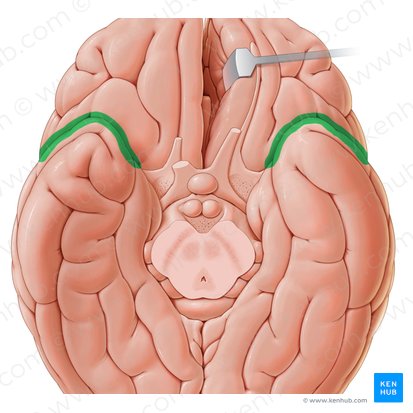 Lateral sulcus (Sulcus lateralis); Image: Paul Kim