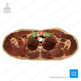 Costa 1 & cartilago costalis 1 (1. Rippe und Rippenknorpel); Bild: National Library of Medicine