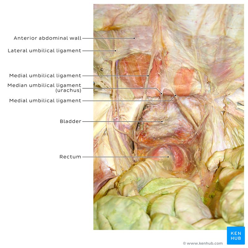 Umbilical structures