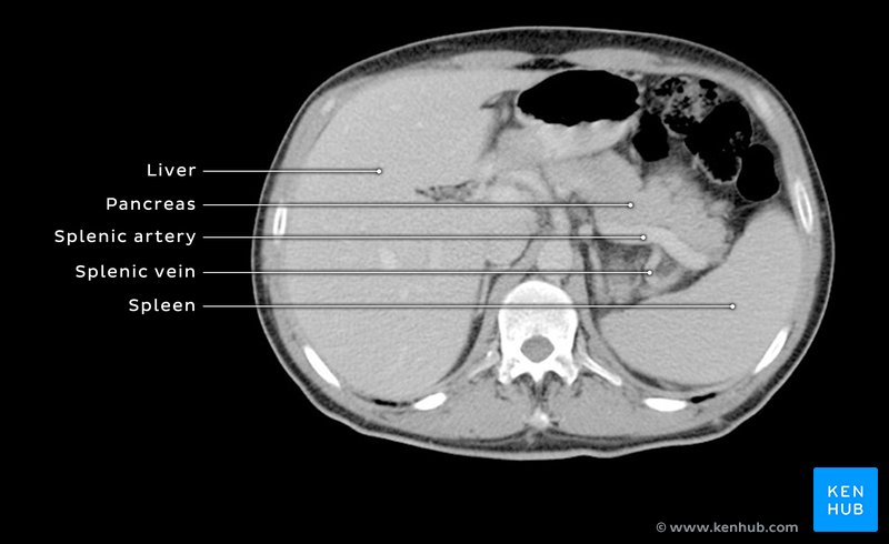 Normal CT showing region of interest