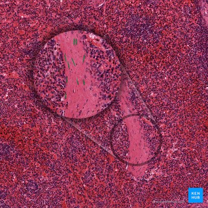Myofibroblasts (Myofibroblasti); Image: 