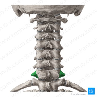 Processus transversus vertebrae C7 (Querfortsatz des Wirbels C7); Bild: Yousun Koh