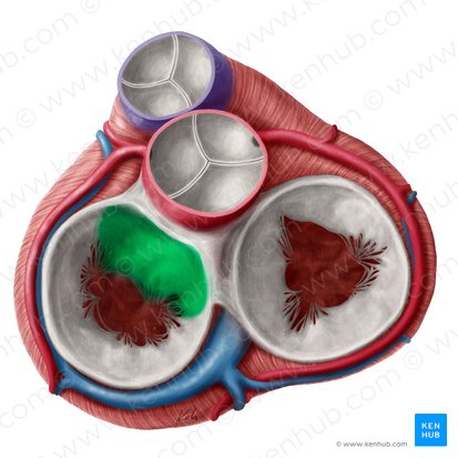 Anterior leaflet of left atrioventricular valve (Cuspis anterior valvae atrioventricularis sinistrae); Image: Yousun Koh