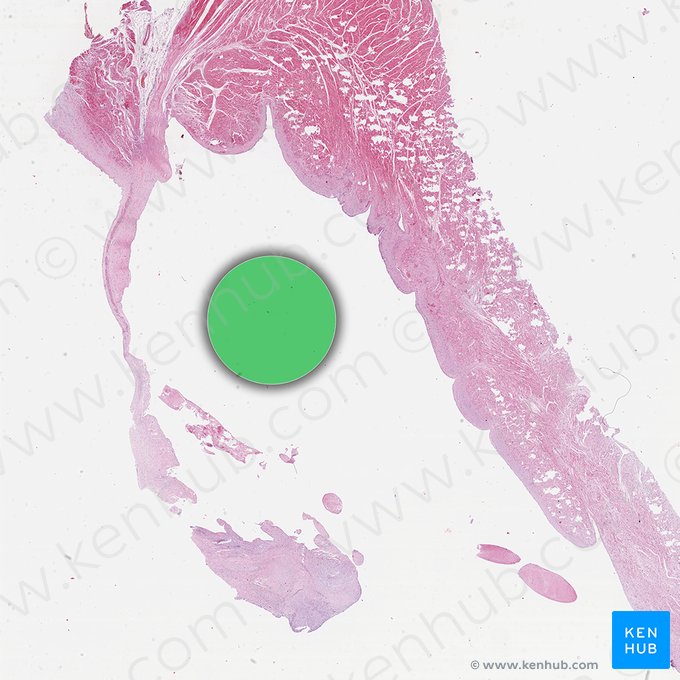 Ventrículo esquerdo do coração (Ventriculus sinister cordis); Imagem: 
