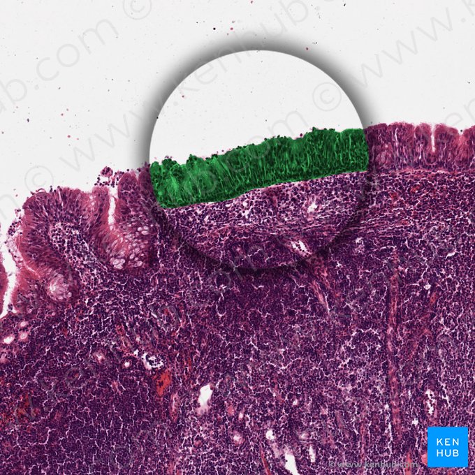 Epitelio cilíndrico pseudoestratificado ciliado con células caliciformes; Imagen: 