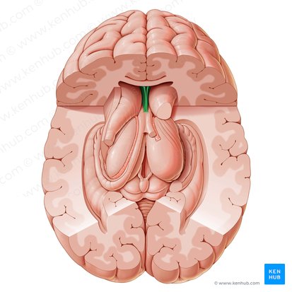 Septum pellucidum; Image: Paul Kim